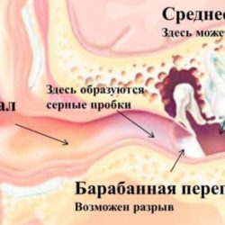 К какому врачу обратиться при переломе уха