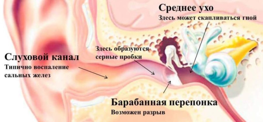 К какому врачу обратиться при переломе уха