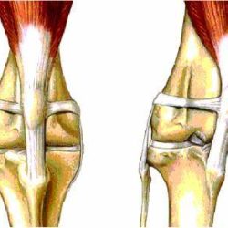 Как лечить вывих коленного сустава у чихуахуа?