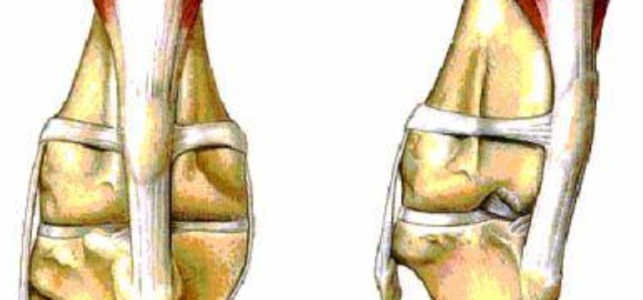 Как лечить вывих коленного сустава у чихуахуа?