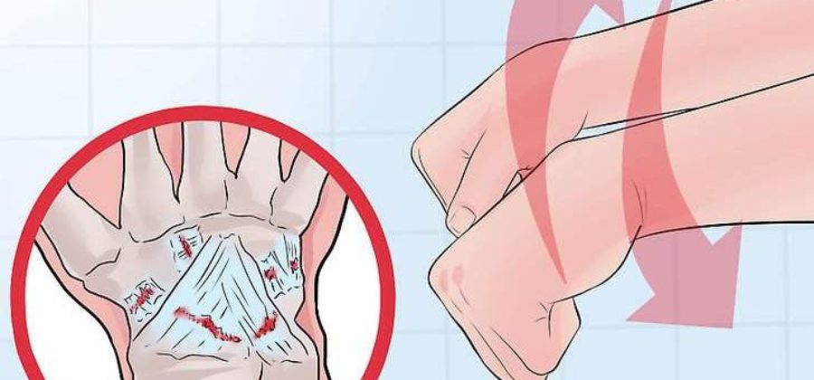 Как сделать повязку на руку при ушибе?