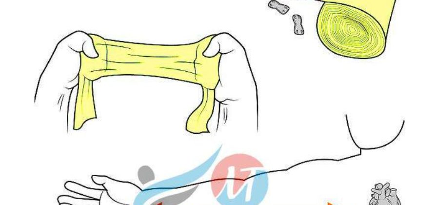 Как наматывать эластичный бинт на руку при ушибе?