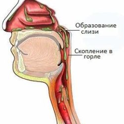 Не могу сглотнуть слизь в горле как будто отек