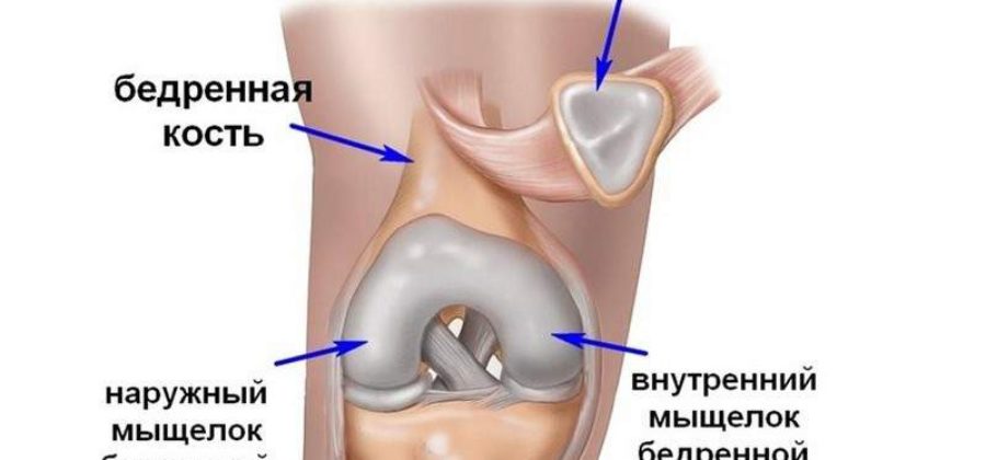 Перелом коленной чашечки какой это вред здоровью