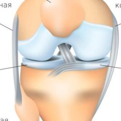 Перелом мыщелка коленного сустава лечение установка пластины