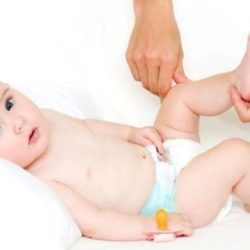 Двухсторонний вывих тазобедренных суставов у новорожденных