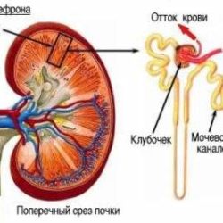 Отеки при остром гломерулонефрите с нефротическим синдромом локальные