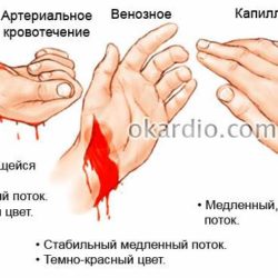 Правила оказания первой медицинской помощи при травмах ушибах кровотечениях
