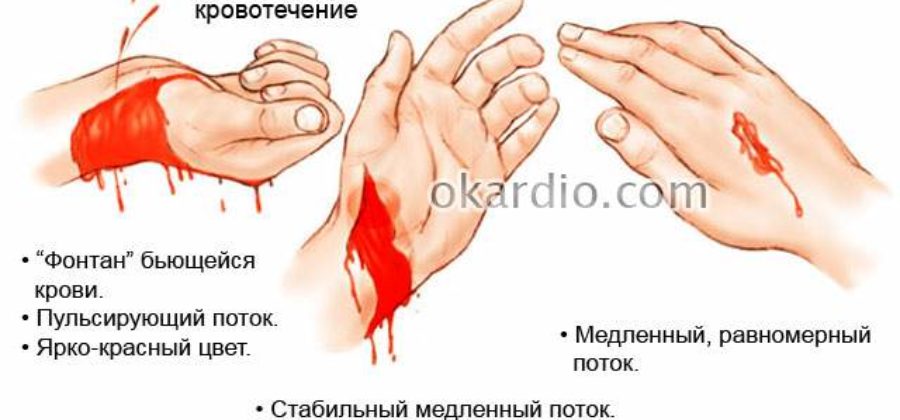 Правила оказания первой медицинской помощи при травмах ушибах кровотечениях