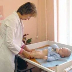 Вывих бедра у новорожденного доктор комаровский