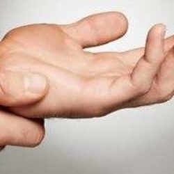 Что делать при сильном ушибе кисти руки в домашних условиях?