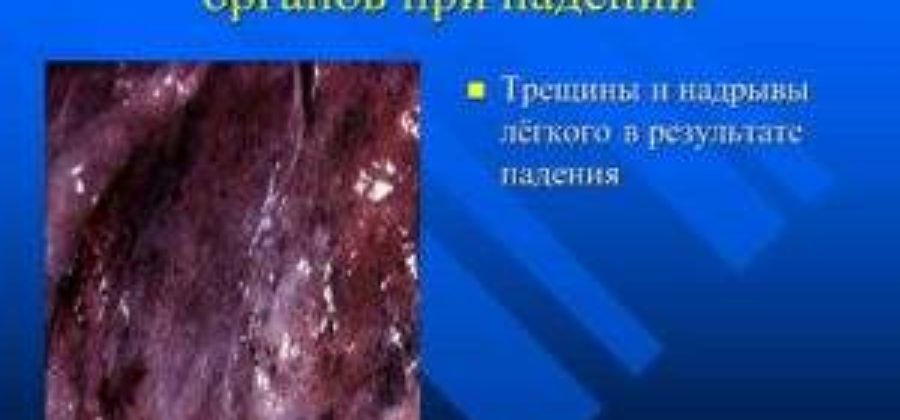 Ушиб внутренних органов при падении на спину симптомы